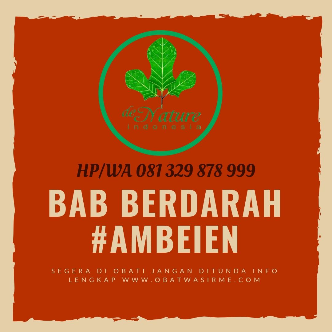 Cara Mengobati Wasir