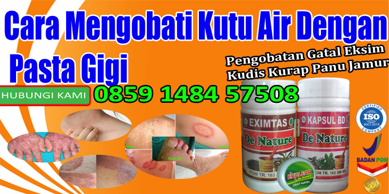 Cara Mengobati Kutu Air Dengan Pasta Gigi