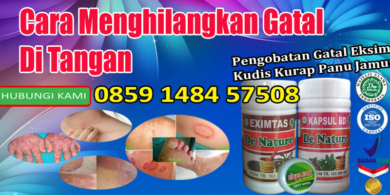 Cara Menghilangkan Gatal Di Tangan