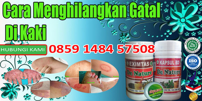 Cara Menghilangkan Gatal Tekak / Tips Cara Menghilangkan Gatal