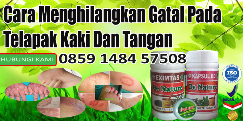 Cara Menghilangkan Gatal Pada Telapak Kaki & Tangan