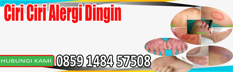 Ciri Ciri Alergi Dingin