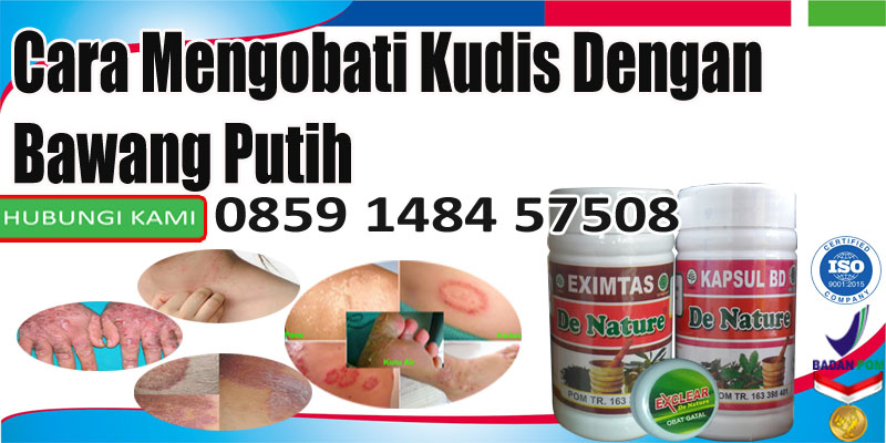 Cara Mengobati Kudis Dengan Bahan Bawang Putih