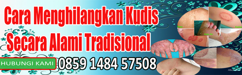Cara Menghilangkan Kudis Secara Alami Tradisional