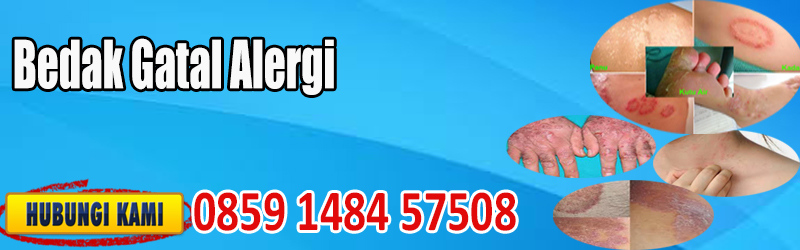 Bedak Gatal Alergi