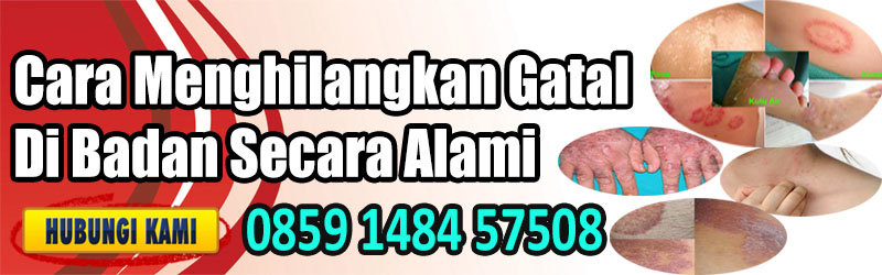 Cara Menghilangkan Gatal Di Badan - farmbee
