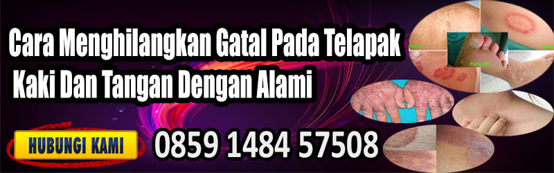 Cara Menghilangkan Gatal Pada Telapak Kaki Dan Tangan